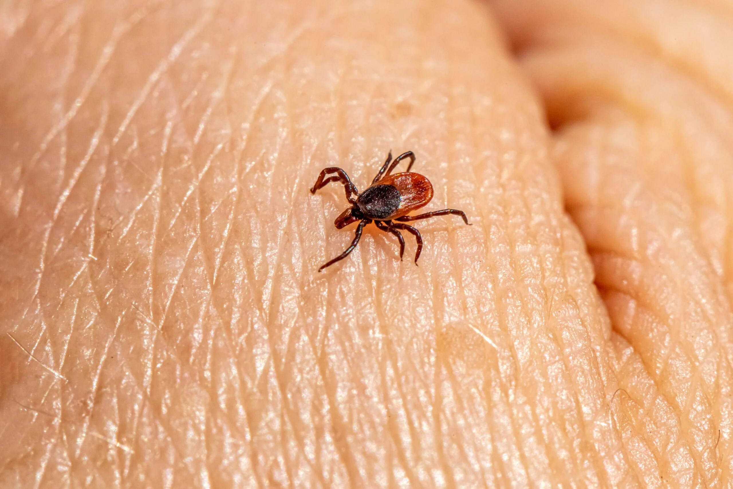 Erkė ant lapo - Laimo ligos diagnostika